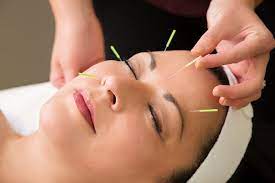 Facial/Cosmetic Acupuncture