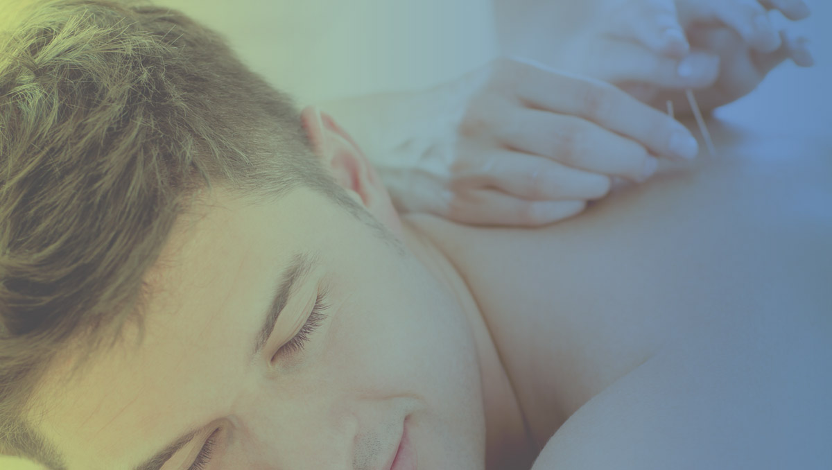 Acupuncture treatment at SOMA Active Health